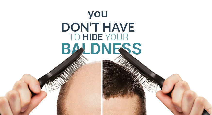 درباره موگه 1 banner1